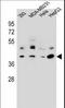 Ras Related GTP Binding C antibody, LS-C162764, Lifespan Biosciences, Western Blot image 