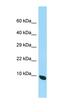 Mitochondrial Contact Site And Cristae Organizing System Subunit 13 antibody, orb325868, Biorbyt, Western Blot image 