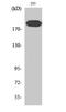 Insulin Receptor Substrate 1 antibody, STJ93772, St John