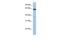 POP2 antibody, GTX47134, GeneTex, Western Blot image 