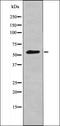 FGR Proto-Oncogene, Src Family Tyrosine Kinase antibody, orb335819, Biorbyt, Western Blot image 