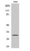 CTD Small Phosphatase 1 antibody, PA5-50941, Invitrogen Antibodies, Western Blot image 