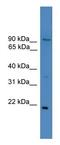 Forkhead Box M1 antibody, GTX17624, GeneTex, Western Blot image 