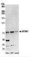 Myotubularin Related Protein 1 antibody, NBP2-44289, Novus Biologicals, Western Blot image 