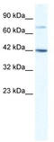 GLI Family Zinc Finger 4 antibody, TA331665, Origene, Western Blot image 