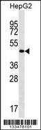 Transmembrane And Coiled-Coil Domain Family 3 antibody, 57-003, ProSci, Western Blot image 