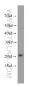 Peroxiredoxin 2 antibody, 20569-1-AP, Proteintech Group, Western Blot image 