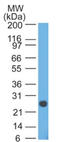 Ig lambda-1 chain C regions antibody, AM32827PU-S, Origene, Western Blot image 