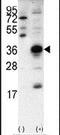 Snail Family Transcriptional Repressor 1 antibody, PA5-11925, Invitrogen Antibodies, Western Blot image 