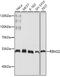RNA Binding Motif Protein 22 antibody, GTX64888, GeneTex, Western Blot image 
