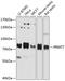 Protein Arginine Methyltransferase 7 antibody, A05485, Boster Biological Technology, Western Blot image 