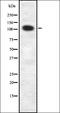 Fibroblast Growth Factor 6 antibody, orb337745, Biorbyt, Western Blot image 