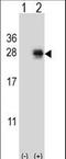Pro-Melanin Concentrating Hormone antibody, LS-C163807, Lifespan Biosciences, Western Blot image 