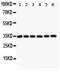 MYD88 Innate Immune Signal Transduction Adaptor antibody, LS-C344009, Lifespan Biosciences, Western Blot image 