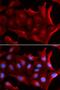 N-Ribosyldihydronicotinamide:Quinone Reductase 2 antibody, LS-C334060, Lifespan Biosciences, Immunofluorescence image 