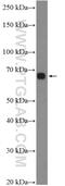 Signal Regulatory Protein Alpha antibody, 14482-1-AP, Proteintech Group, Western Blot image 