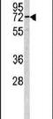 Carcinoembryonic Antigen Related Cell Adhesion Molecule 4 antibody, PA5-13438, Invitrogen Antibodies, Western Blot image 