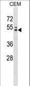 Adaptor Related Protein Complex 4 Subunit Mu 1 antibody, LS-C159084, Lifespan Biosciences, Western Blot image 