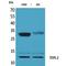 Tissue Factor Pathway Inhibitor 2 antibody, LS-C386915, Lifespan Biosciences, Western Blot image 