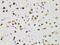 Galectin 3 antibody, GTX55633, GeneTex, Immunohistochemistry paraffin image 