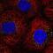 Perilipin 3 antibody, NBP2-49485, Novus Biologicals, Immunocytochemistry image 