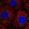 Perilipin-3 antibody, NBP2-49485, Novus Biologicals, Immunocytochemistry image 