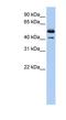 Deoxyribonuclease-2-beta antibody, NBP1-62279, Novus Biologicals, Western Blot image 