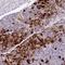 Annexin A2 Receptor antibody, NBP2-49008, Novus Biologicals, Immunohistochemistry paraffin image 