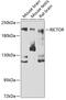 RPTOR Independent Companion Of MTOR Complex 2 antibody, 22-021, ProSci, Western Blot image 