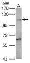 DEAD-Box Helicase 20 antibody, PA5-29198, Invitrogen Antibodies, Western Blot image 