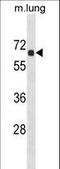 Acyl-CoA Thioesterase 9 antibody, LS-C160999, Lifespan Biosciences, Western Blot image 