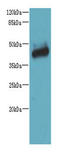 Alpha-N-acetylgalactosaminide alpha-2,6-sialyltransferase 2 antibody, A67786-100, Epigentek, Western Blot image 