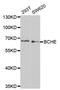 Butyrylcholinesterase antibody, LS-C331478, Lifespan Biosciences, Western Blot image 