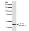 Sodium channel subunit beta-3 antibody, NBP2-59318, Novus Biologicals, Western Blot image 