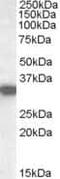 Hydroxyacyl-CoA Dehydrogenase antibody, PA5-18840, Invitrogen Antibodies, Western Blot image 