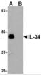 Interleukin 34 antibody, NBP1-76357, Novus Biologicals, Western Blot image 