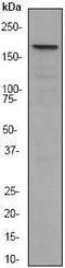 Bromodomain Adjacent To Zinc Finger Domain 1B antibody, ab51256, Abcam, Western Blot image 