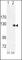 Tyrosine-protein kinase transmembrane receptor ROR2 antibody, F50669-0.4ML, NSJ Bioreagents, Immunohistochemistry paraffin image 