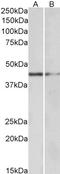 GATA Binding Protein 3 antibody, orb18417, Biorbyt, Western Blot image 