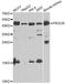 Protein C Receptor antibody, A5763, ABclonal Technology, Western Blot image 