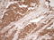 Matrix Metallopeptidase 3 antibody, LS-C791051, Lifespan Biosciences, Immunohistochemistry paraffin image 