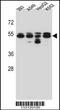 Tubulin Beta 8 Class VIII antibody, 56-949, ProSci, Western Blot image 