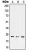 Integrin Subunit Alpha 7 antibody, orb214121, Biorbyt, Western Blot image 