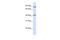 Thioredoxin Related Transmembrane Protein 4 antibody, 26-431, ProSci, Enzyme Linked Immunosorbent Assay image 