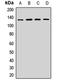 Huntingtin Interacting Protein 1 Related antibody, orb411895, Biorbyt, Western Blot image 