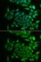Retinol Binding Protein 2 antibody, GTX33462, GeneTex, Immunofluorescence image 
