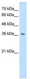 Wnt Family Member 16 antibody, TA344074, Origene, Western Blot image 