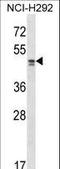 TADA2A antibody, LS-C161682, Lifespan Biosciences, Western Blot image 