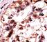 Mitogen-Activated Protein Kinase 6 antibody, F53755-0.4ML, NSJ Bioreagents, Immunohistochemistry paraffin image 