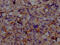 Activin A Receptor Like Type 1 antibody, CSB-RA555022A0HU, Cusabio, Immunohistochemistry frozen image 